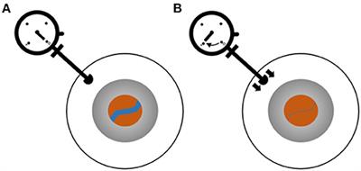 Retinal Vein Changes as a Biomarker to Guide Diagnosis and Management of Elevated Intracranial Pressure